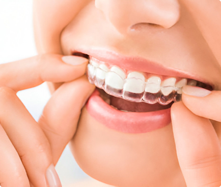 Laser-Assisted Root Canal Therapys